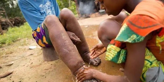 Example of Neglected Tropical Diseases