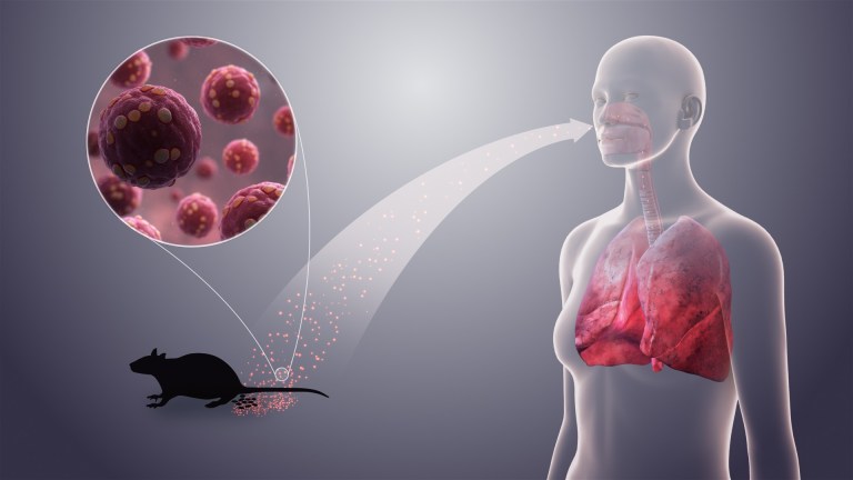 Hantavirus infection
