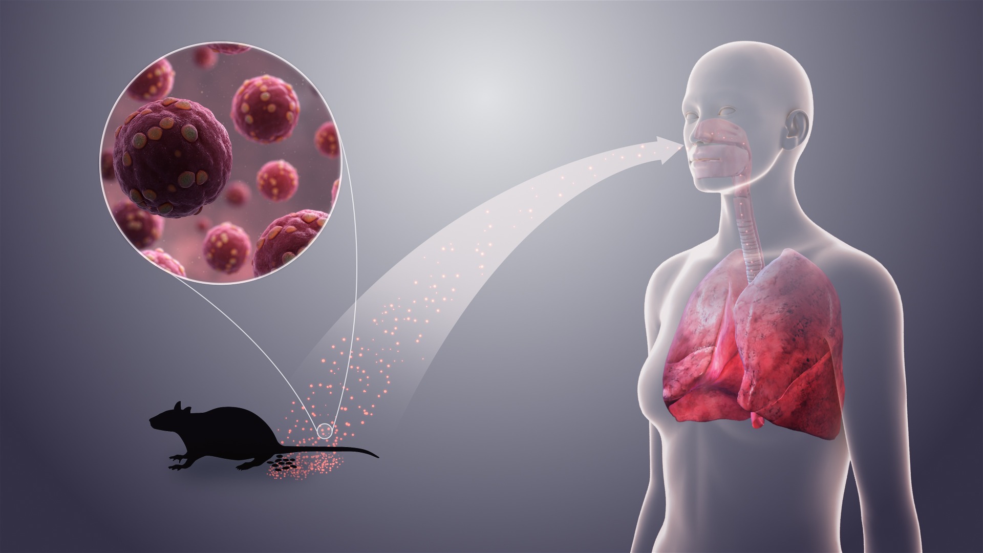 Hantavirus infection