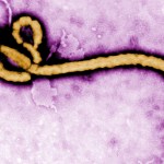 Ebola Virus