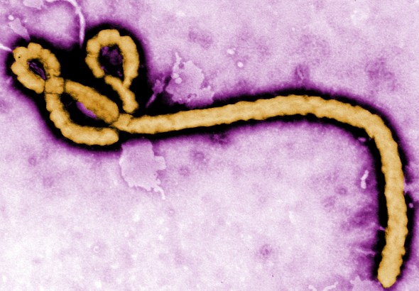 Ebola Virus